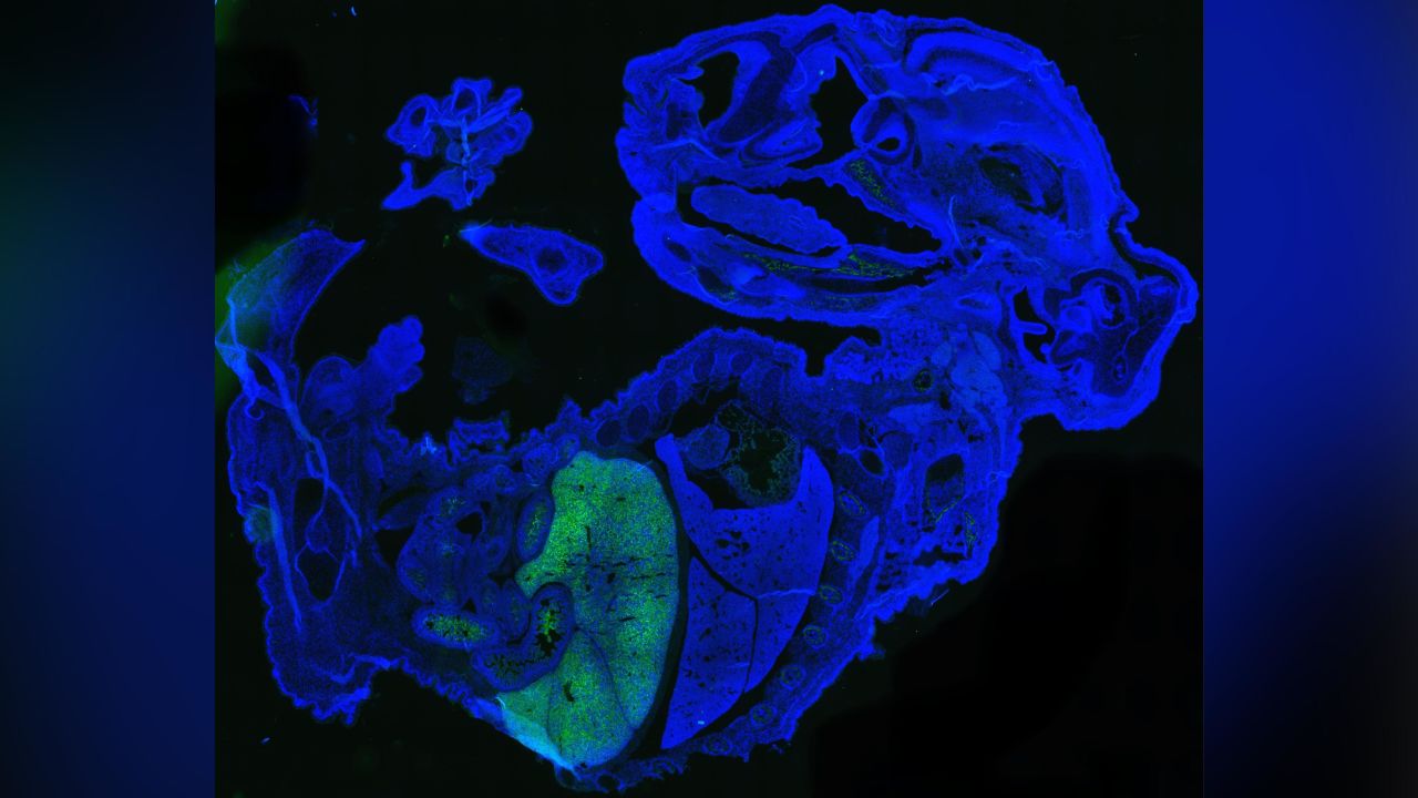 This figure shows a large quantity of human cells (labeled green) in a 17-day old mouse embryo (labeled blue). Most of the human cells are red blood cells, which are accumulated in the mouse fetal liver.