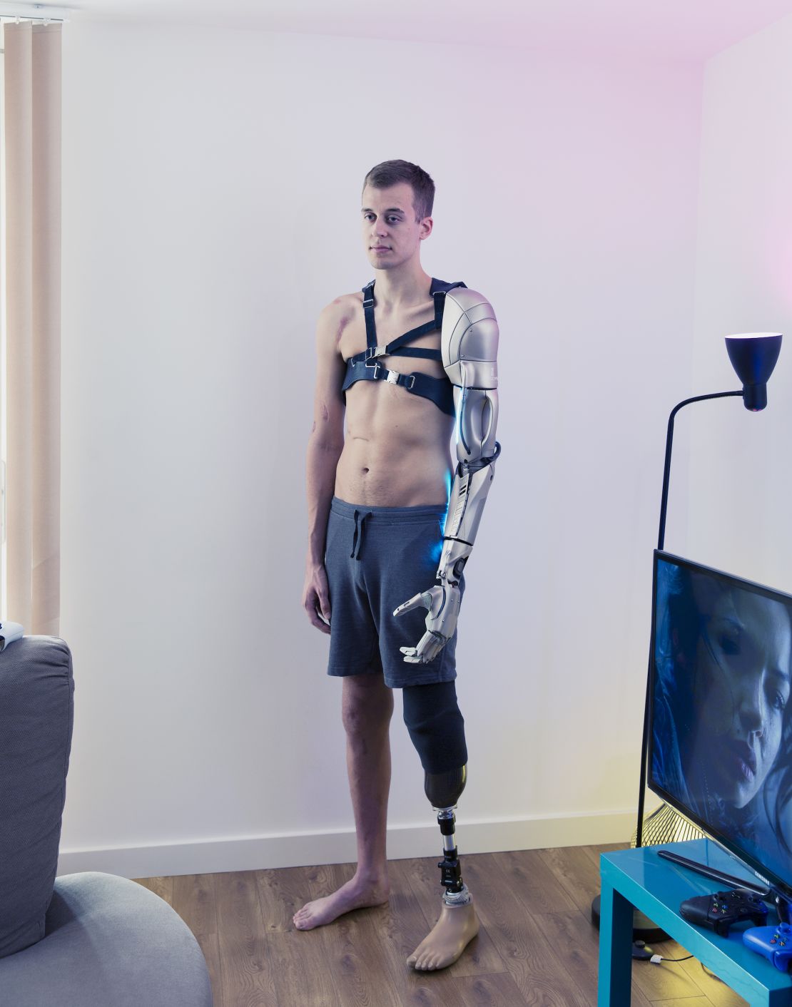 James Young has always been drawn to the aesthetics of science fiction. Following his accident, he came to see "re-building" his body as part of his recovery process.
