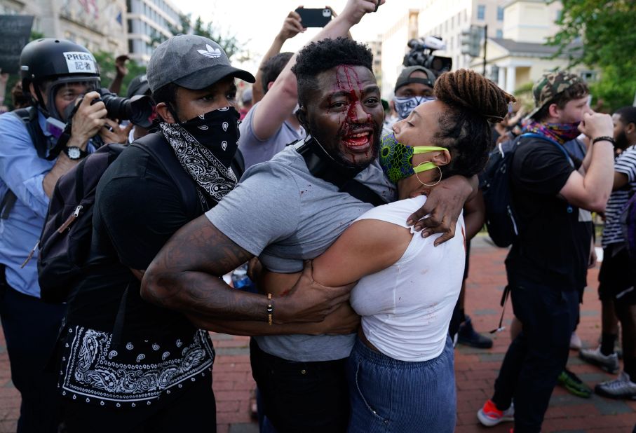 A demonstrator is injured during a protest near the White House on May 30.