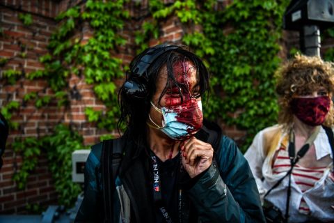 Journalist Ed Ou is seen bleeding on May 30 after police fired tear gas and rubber bullets at protesters violating curfew in Minneapolis. He suffered a scalp wound and needed several stitches.