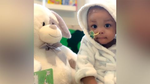 Baby Blake after surgery on h is brain tumor.
