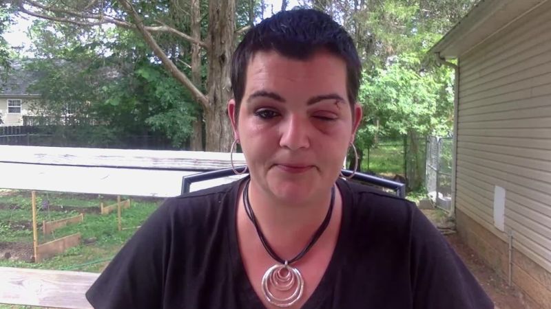 Journalist Blinded At Protest Is Suing Police Cnn Business