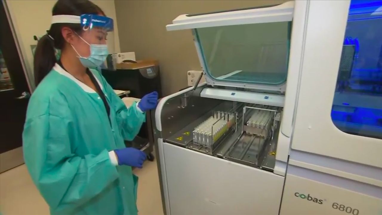 A scientist at UC San Diego running Covid-19 tests on students' samples