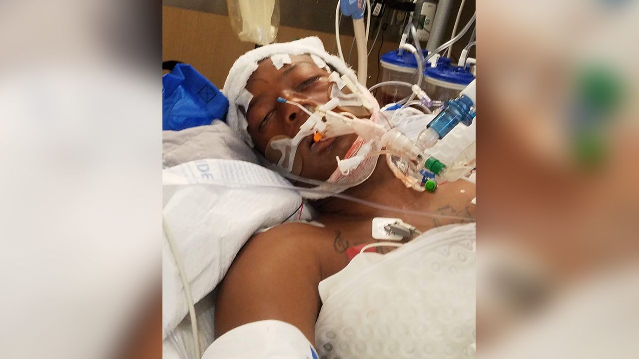 Elijah McClain lies in the hospital after his confrontation with Aurora police in August 2019.