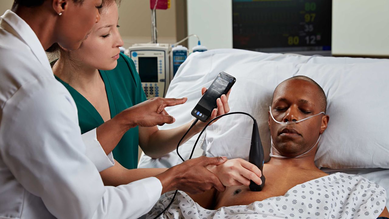 butterfly iq portable ultrasound device - RESTRICTED