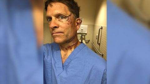 Dave Chernosky is recovering from cuts to his face and back after an encounter with a bear that got into the kitchen of the house where he's staying.