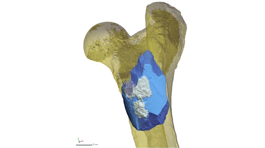 The bone handaxe is shown placed in a hippopotamus femur.