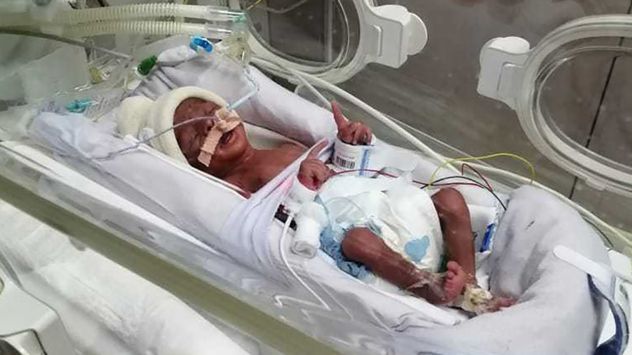 The quadruplet babies were born July 1 at the Latifah Women and Children's Hospital in Dubai.