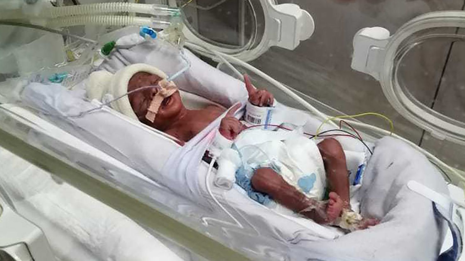 The quadruplet babies were born July 1 at the Latifa Women and Children Hospital in Dubai.