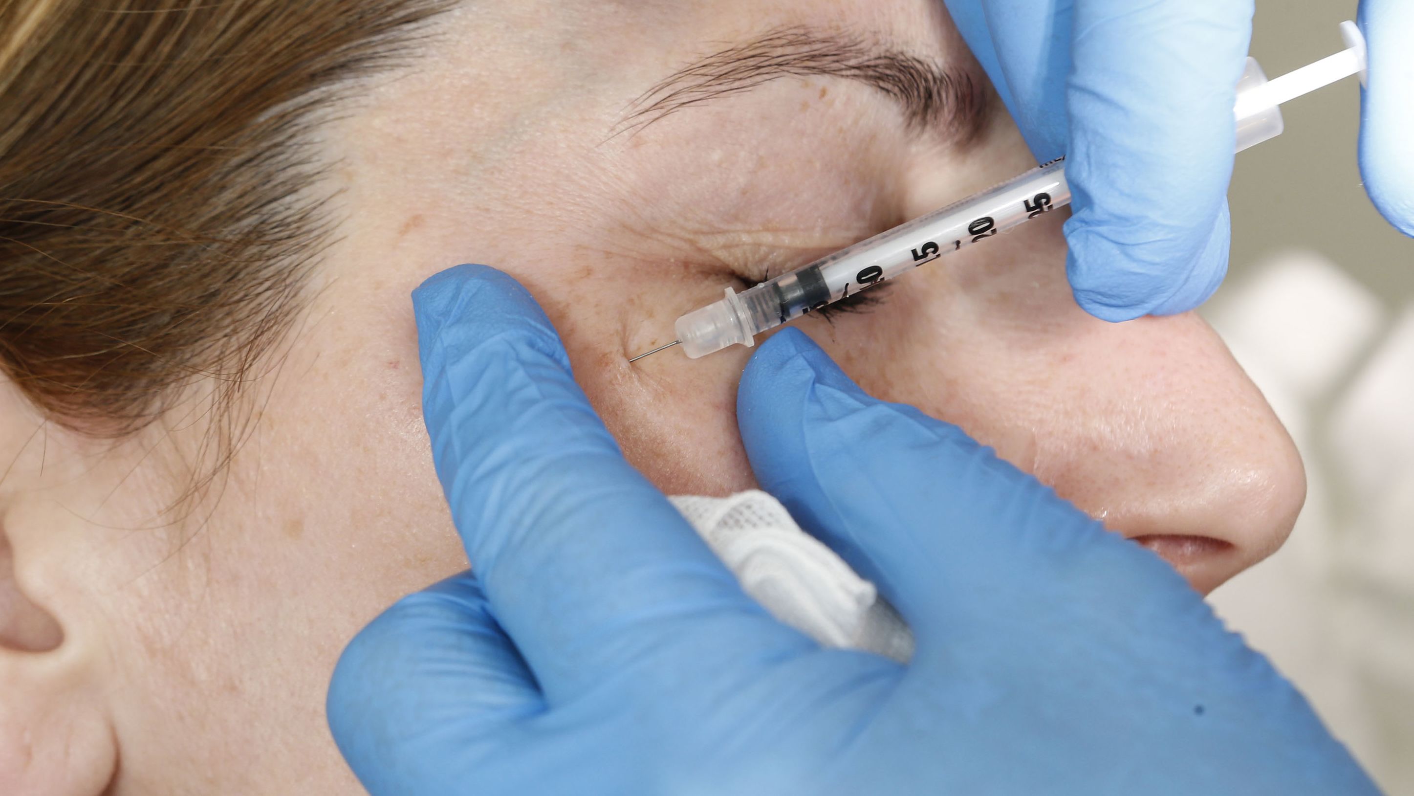 A specialist performs a Botox injection on a patient.