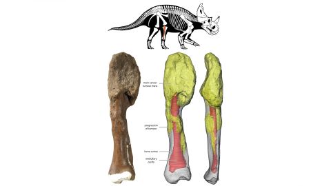 The dinosaur's main tumor mass is at the top of the bone, and can be seen on the 3D reconstruction in yellow. Centrosaurus diagram by Danielle Dufault. Courtesy of Royal Ontario Museum.