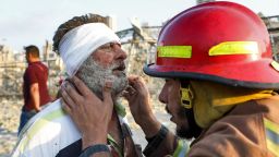 TOPSHOT - A wounded man is checked by a fireman near the scene of an explosion in Beirut on August 4, 2020. - A large explosion rocked the Lebanese capital Beirut on August 4, an AFP correspondent said. The blast, which rattled entire buildings and broke glass, was felt in several parts of the city. (Photo by Anwar AMRO / AFP) (Photo by ANWAR AMRO/AFP via Getty Images)