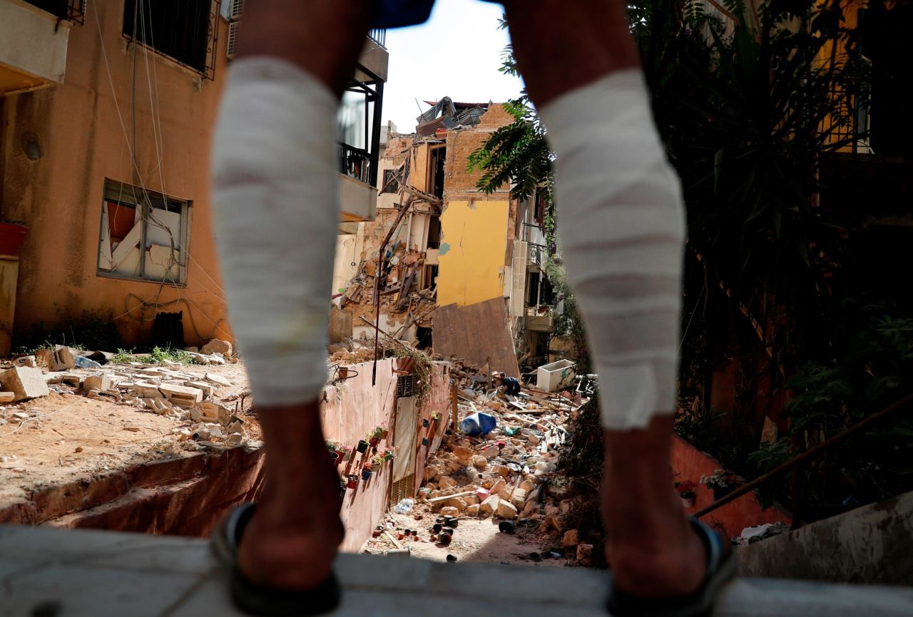A man whose legs were injured because of the explosion looks at a destroyed house on August 7, 2020.