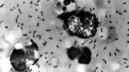 UNDATED PHOTO:  A bubonic plague smear, prepared from a lymph removed from an adenopathic lymph node, or bubo, of a plague patient, demonstrates the presence of the Yersinia pestis bacteria that causes the plague in this undated photo. The FBI has confirmed that about 30 vials that may contain bacteria that could cause bubonic or pneumonic plague have gone missing, then found, from the Health Sciences Center at Texas Tech University January 15, 2003 in Lubbock, Texas. The plague, considered a likely bioterror agent since it's easy to make, is easily treatable with antibiotics if diagnosed early and properly.  (Photo by Centers for Disease Control and Prevention/Getty Images)