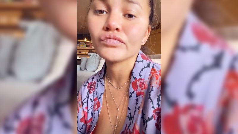 Chrissy Teigen Says Her Tongue Is Suffering From Eating Sour Candy ...