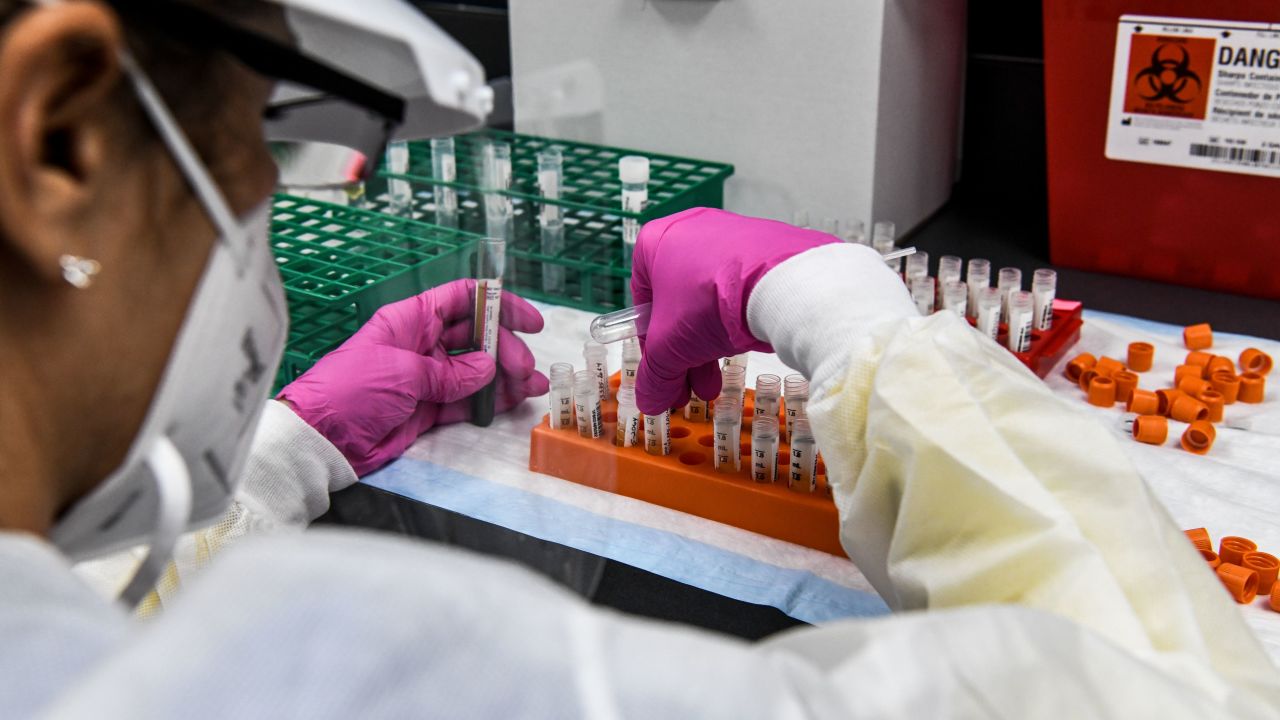 A lab technician sorts blood samples inside a lab for a COVID-19 vaccine study at the Research Centers of America (RCA) in Hollywood, Florida, on August 13, 2020. - So-called phase three vaccine clinical trials, in which thousands of people take part in the final stages, are gaining traction in Florida. With more than half a million cases and over 9,000 deaths, Florida ranks second in the US in total cases behind California, making it an ideal place to carry out the trials. That has led to a flurry of activity at the RCA, a private center carrying out clinical trials in Hollywood, 25 miles (40kms) north of Miami. (Photo by CHANDAN KHANNA / AFP) (Photo by CHANDAN KHANNA/AFP via Getty Images)