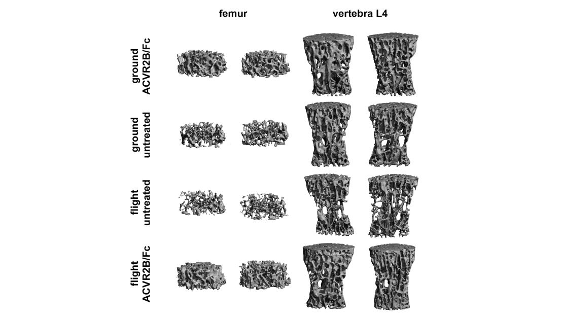This chart compares microCT images of femurs and vertebrae of treated and untreated mice exposed to a lack of gravity in space.