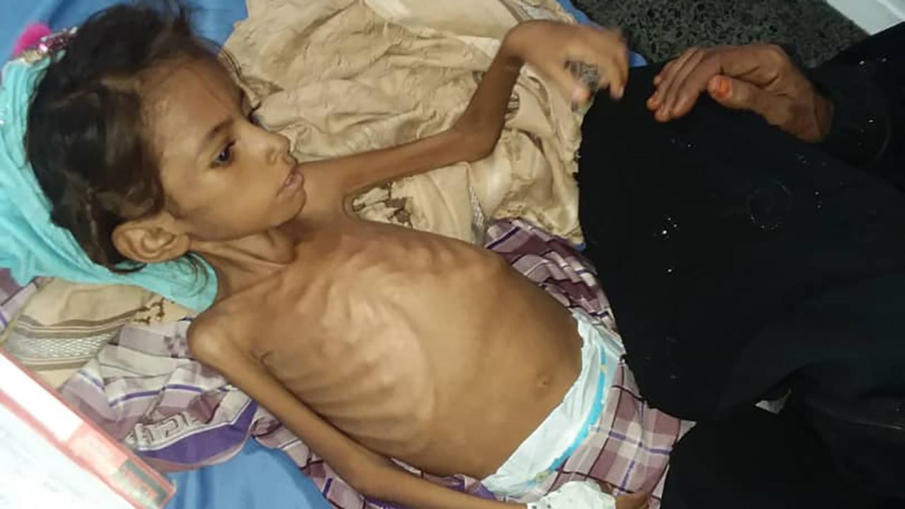 In Yemen aid workers already fear famine for much of the impoverished population.