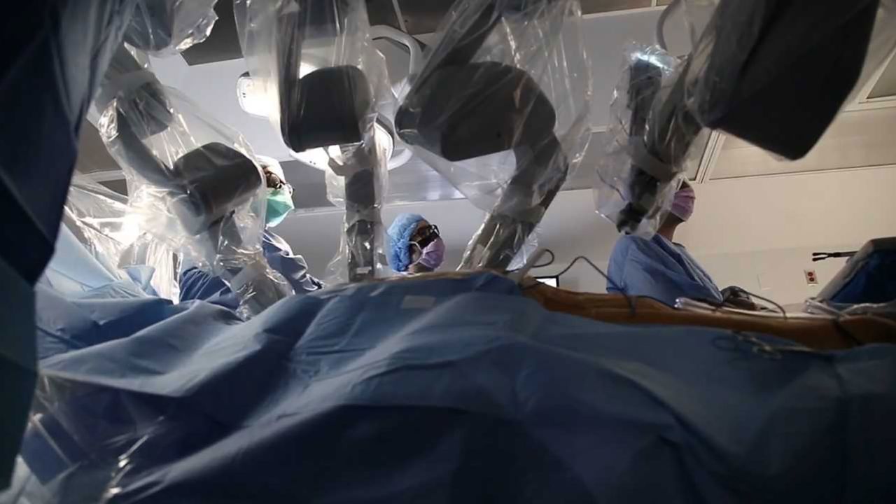 Above is an example of the robotic surgery performed on Ed Bettinelli.