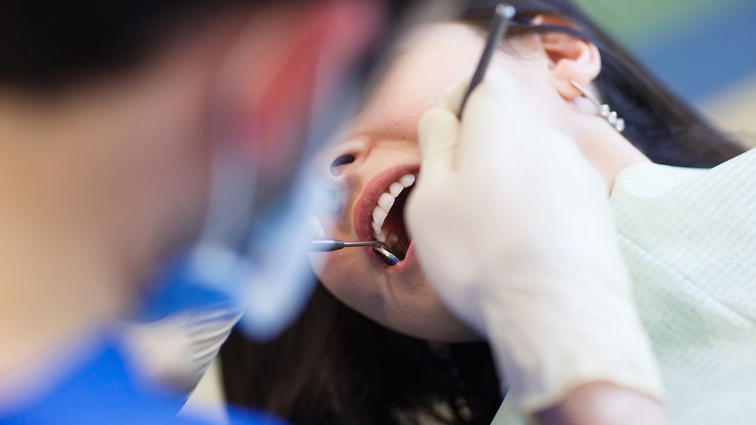 The FDA warned Thursday that dental amalgam filling may cause health issues for some high-risk groups.