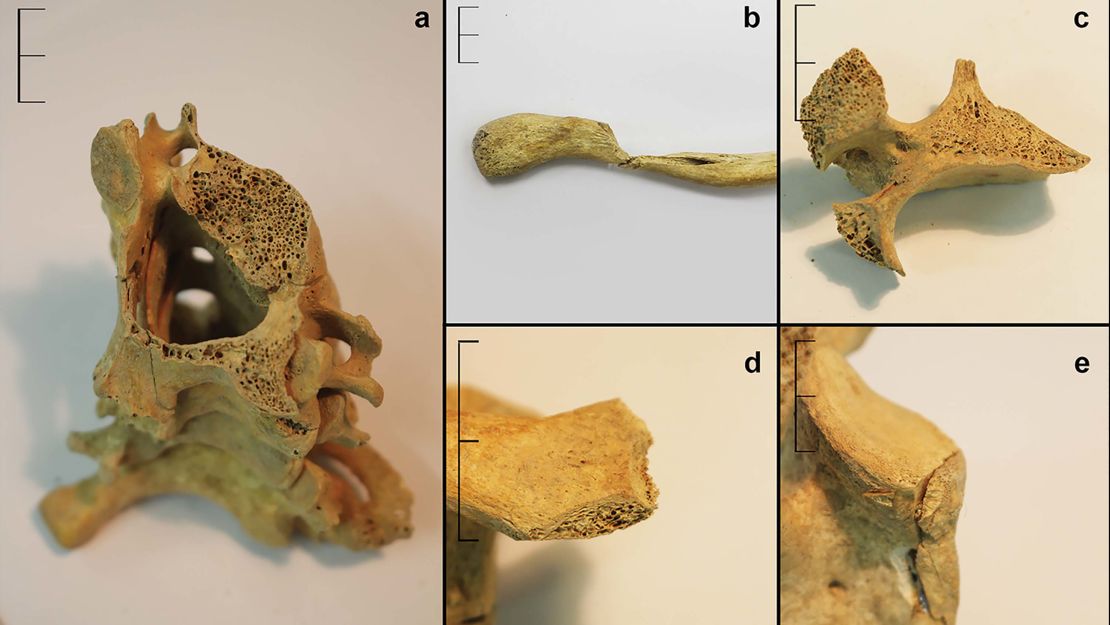 Analysis of the skeletons showed some people had been left where they fell in the streets.