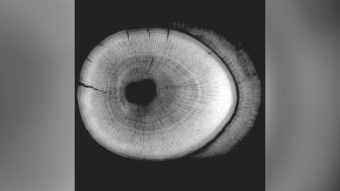 A micro-CT scan of a fossil Morganucodon tooth root from 200 million years ago, showing annual growth rings.