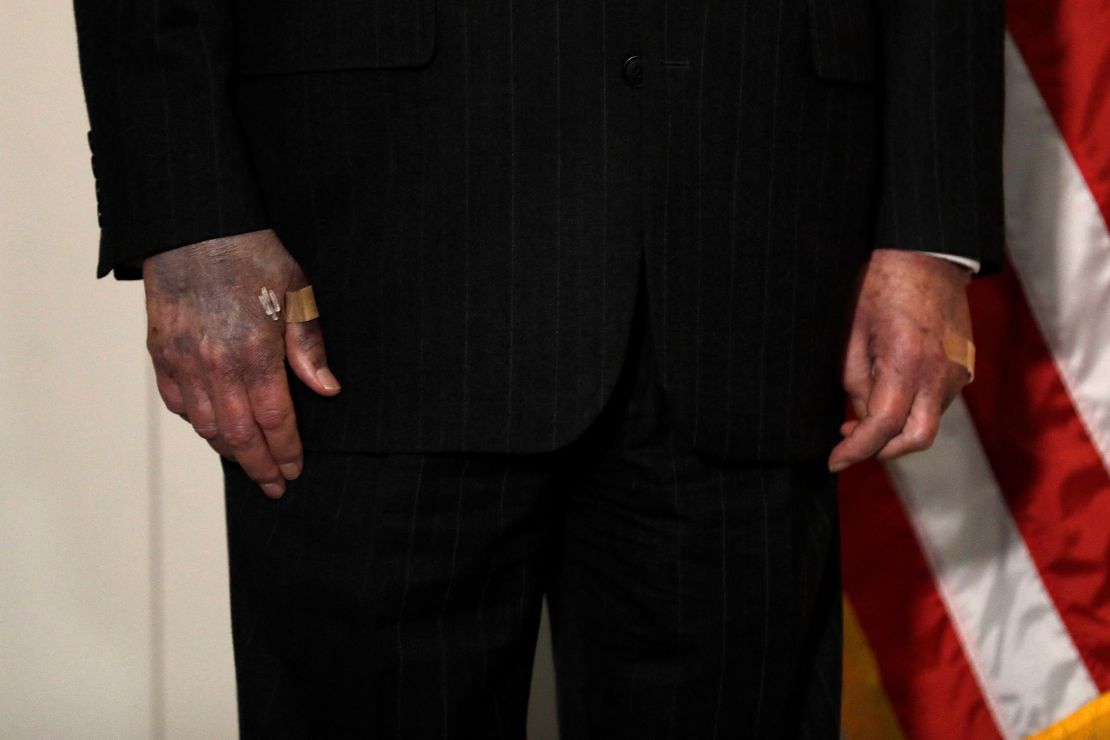 The hands of Senate Majority Leader Mitch McConnell are seen as he talks to the media after the Republican policy luncheon on Capitol Hill on October 20, 2020. 