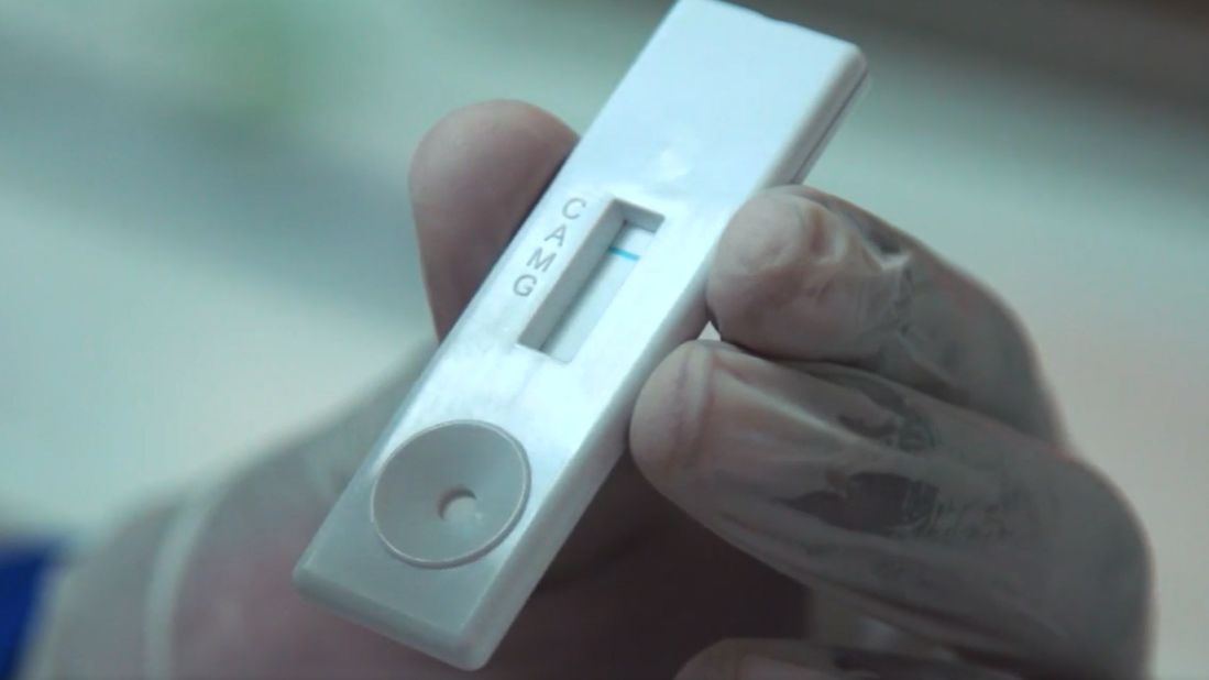 This rapid test kit developed in Senegal is the latest innovation designed to help fight the pandemic in Africa. A small finger-prick of blood, much like an insulin test, is read by the plastic stick  and delivers a result in less than 10 minutes.<br /><strong>Scroll through the gallery to see more Covid-19 innovations from across the continent.</strong>