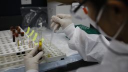 A health worker wearing a protective mask works in a lab during clinical trials for a Covid-19 vaccine at Research Centers of America in Hollywood, Florida, U.S., on Wednesday, Sept. 9, 2020. Drugmakers racing to produce Covid-19 vaccines pledged to avoid shortcuts on science as they face pressure to rush a shot to market. Photographer: Eva Marie Uzcategui/Bloomberg via Getty Images