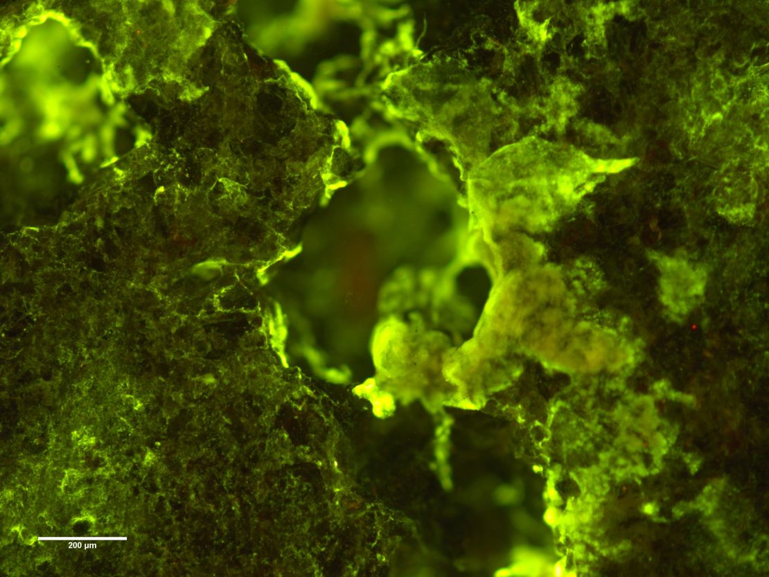 Sphingomonas desiccabilis is the bacterium that was shown to biomine rare earth elements, shown growing on basalt rock. 