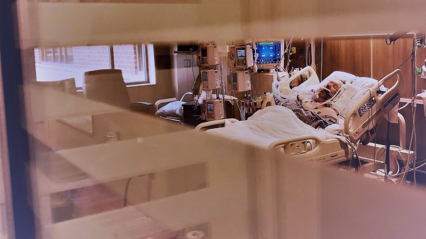 An ICU nurse took this photo of David Johnson for his family after doctors said Johnson's chance of surviving were approaching "statistically zero." 