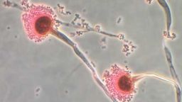 Aspergillus, a type of fungi, is expanding its range as the world heats up, according to new research.