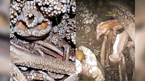 Shown at left is the skull of Altamura Man, a Neanderthal who died in a cave in southern Italy at least 130,000 years ago. His skeleton is covered in calcite mineral deposits.