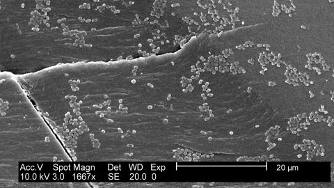E coli bacteria grows in  biofilm on a polyarbonate material.  