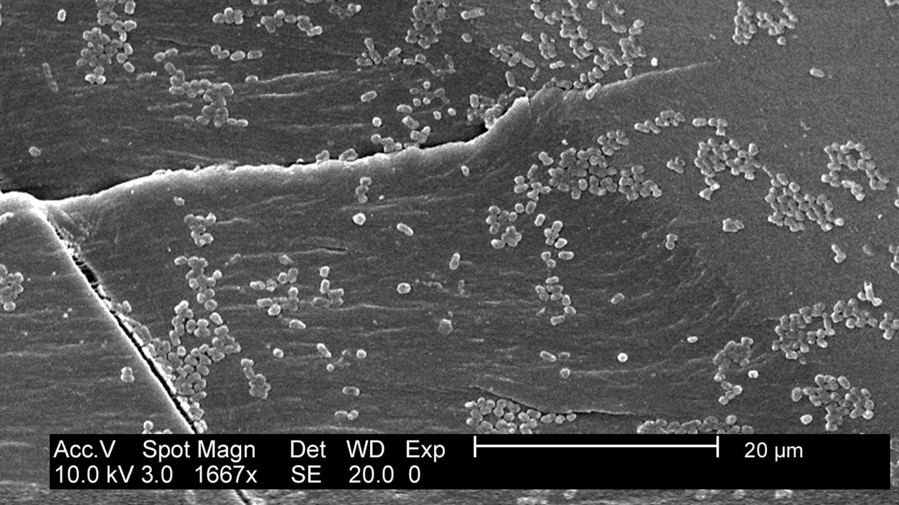 E coli bacteria grows in biofilm on a polyarbonate material.