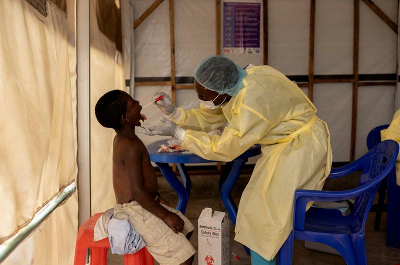 Deadlier Strain Of Mpox Spreads To More Countries, Raising Officials ...