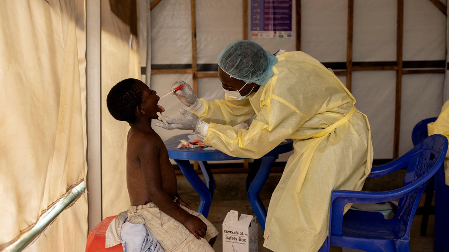 A nurse takes a sample from a child suspected of having mpox at a treatment centre in Munigi,  Democratic Republic of Congo, in July.