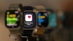 Your Apple watch may be able to alert you to sleep apnea. Here's what it means if you get that notification and what you should do next.