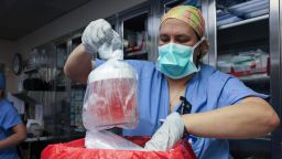 Melissa Mattola-Kiatos, RN, Nursing Practice Specialist, removes the pig kidney from its box to prepare for transplantation.