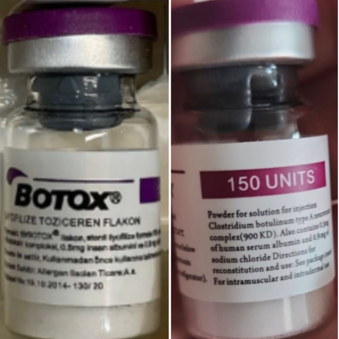Counterfeit Botox cartons and bottles may indicate 150-unit doses, which are not units made by the companies AbbVie or Allergan, the FDA said.