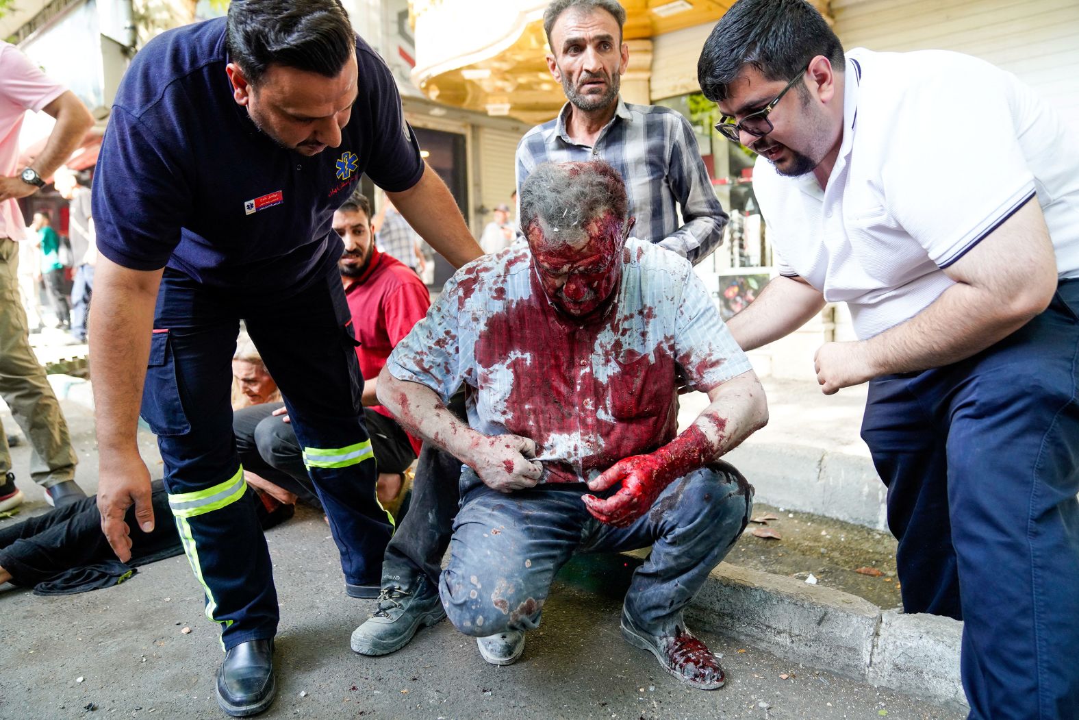 A wounded man looks at his shirt following Israeli strikes in Tehran, Iran, on Sunday.
