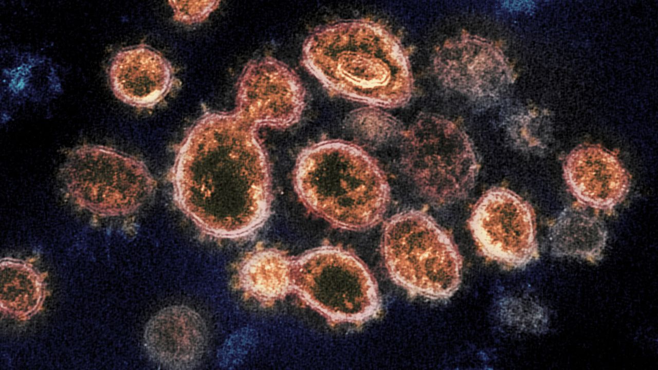 A microscope image of SARS-CoV-2, the coronavirus that causes Covid-19.