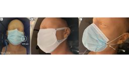 Masks tested, including A, unknotted medical procedure mask; B, double mask (cloth mask covering medical procedure mask); and C, knotted/tucked medical procedure mask