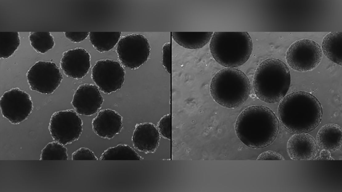 Neanderthal-ized brain organoids (left) look very different than modern human brain organoids (right). 