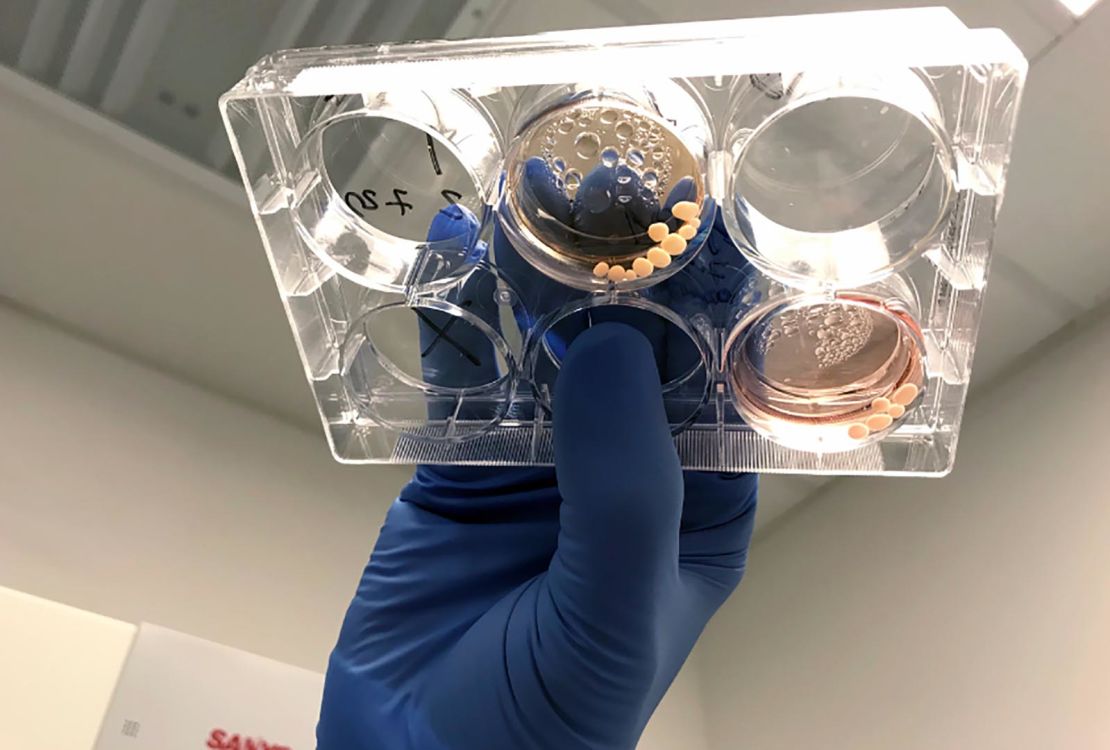 Brain organoids in a petri dish are shown here.