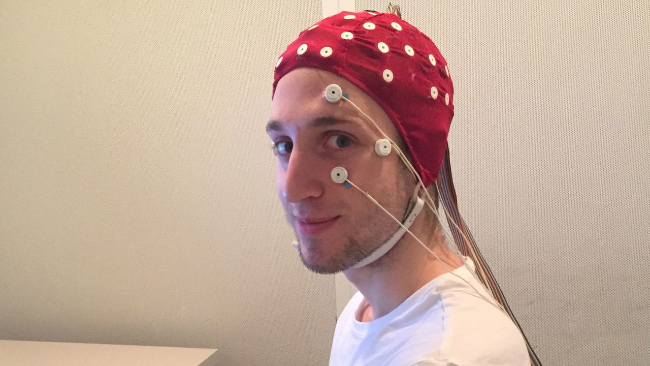A study participant in a full EEG rig just before a sleep session in the lab. The electrodes on his face will detect the movement of his eyes as he sleeps.