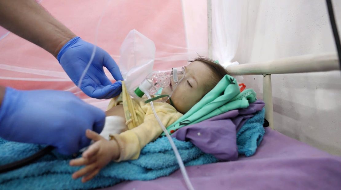 Ten-month-old Hassan Ali, who died in a hospital in Abs, Yemen, where he was being treated for malnutrition.