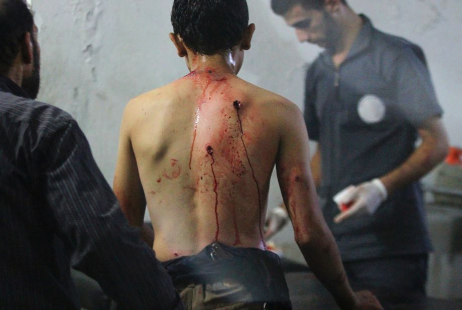 Medics tend to a man's injuries at a field hospital in Douma after airstrikes on September 20, 2014.