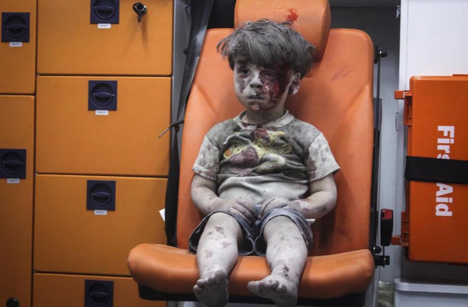 This still image, taken from a video posted by the Aleppo Media Center, shows a young boy in an ambulance after an airstrike in Aleppo, Syria, on August 17, 2016. It took nearly an hour to dig the boy, identified as Omran Daqneesh, out from the rubble, an activist told CNN. The airstrike destroyed his home, where he lived with his parents and two siblings. Director of the Aleppo Media Center Yousef Saddiq said Omran's 10-year-old brother, Ali, died from his injuries.