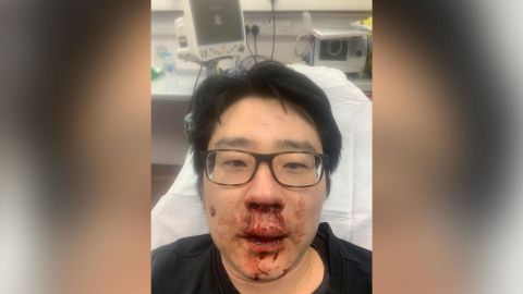 Peng Wang, a university professor, was attacked while out on a jog in late February in Southampton, southern England.
